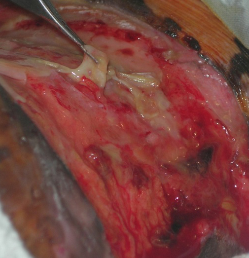 Soft tissue repair, Day 4